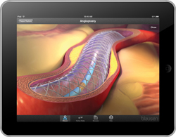 The Human Atlas app uses 3-D animations to teach patients about common medical conditions. 